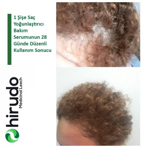 Hirudo - Leech Hair Saç Yoğunlaştırıcı Bakım Serumu